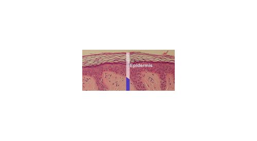 Senescence and skin: what progress?